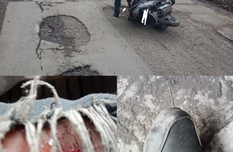 Gara-Gara Jalan Aspal Rusak dan Berlubang Seorang Pria Jatuh Dari Motor Sampai Terluka Serius.